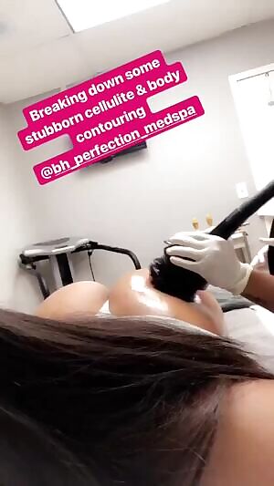 Taking care of the cellulite