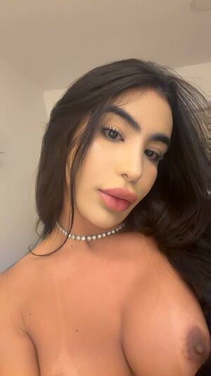 Trans Women Transgender