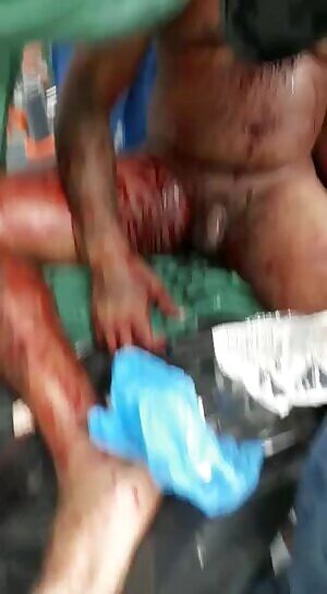 Drug dealer hit by a rifle shot!