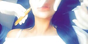 Lauren getting her lips filled