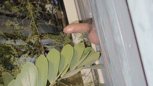 Tight Foreskin (Phimosis) Balls Hair Pissing