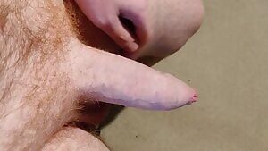 Is there such a thing as too much foreskin?