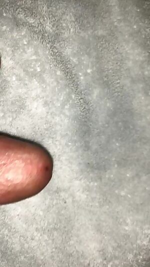 For my foreskin lovers🥰 kik gillianbehr