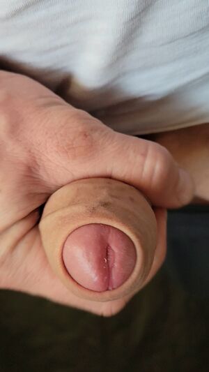 Foreskin Amateur Big Dick Close Up