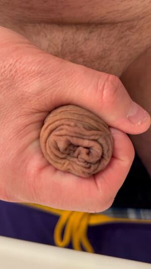 Foreskin Amateur Homemade Uncircumcised Uncut