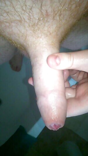 Wet foreskin