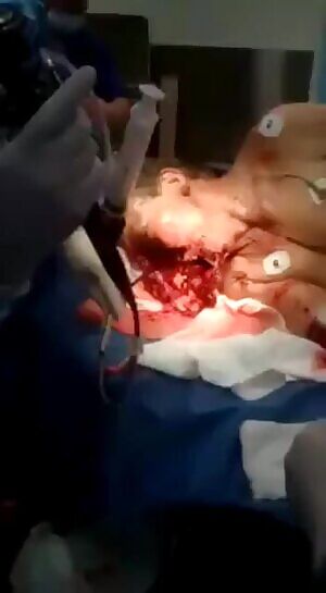 Alleged victim of chimp attack