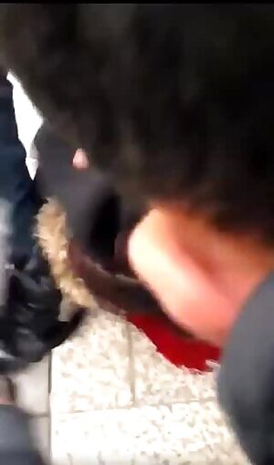 Medic helps a young girl who lost her eye from a flash ball shot fired by the police in France