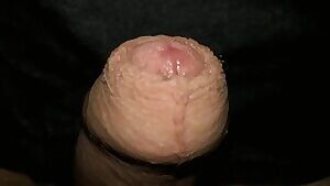 Glans Liberation Struggle ;)