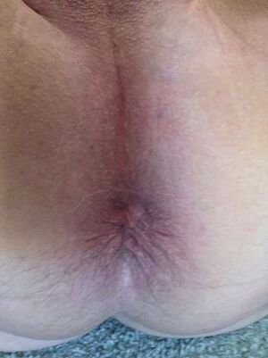 Man Ass Amateur Anal Asshole Exhibitionist