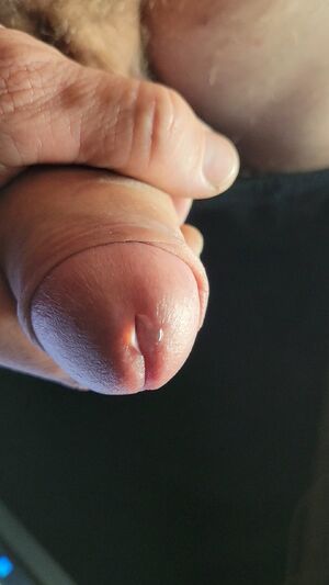 Foreskin Amateur Big Dick Close Up
